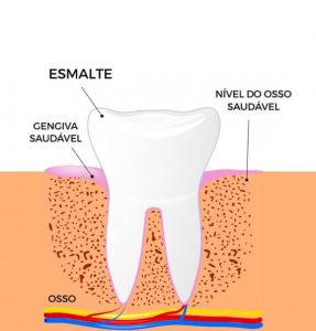 Periodontite pós tratamento Ilustração da periodontite pós tratamento